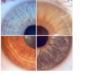 Arbeitskreis - Augendiagnose
