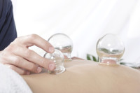 Schröpftherapie Schröpftherapie