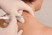 Neuraltherapie für Anfänger